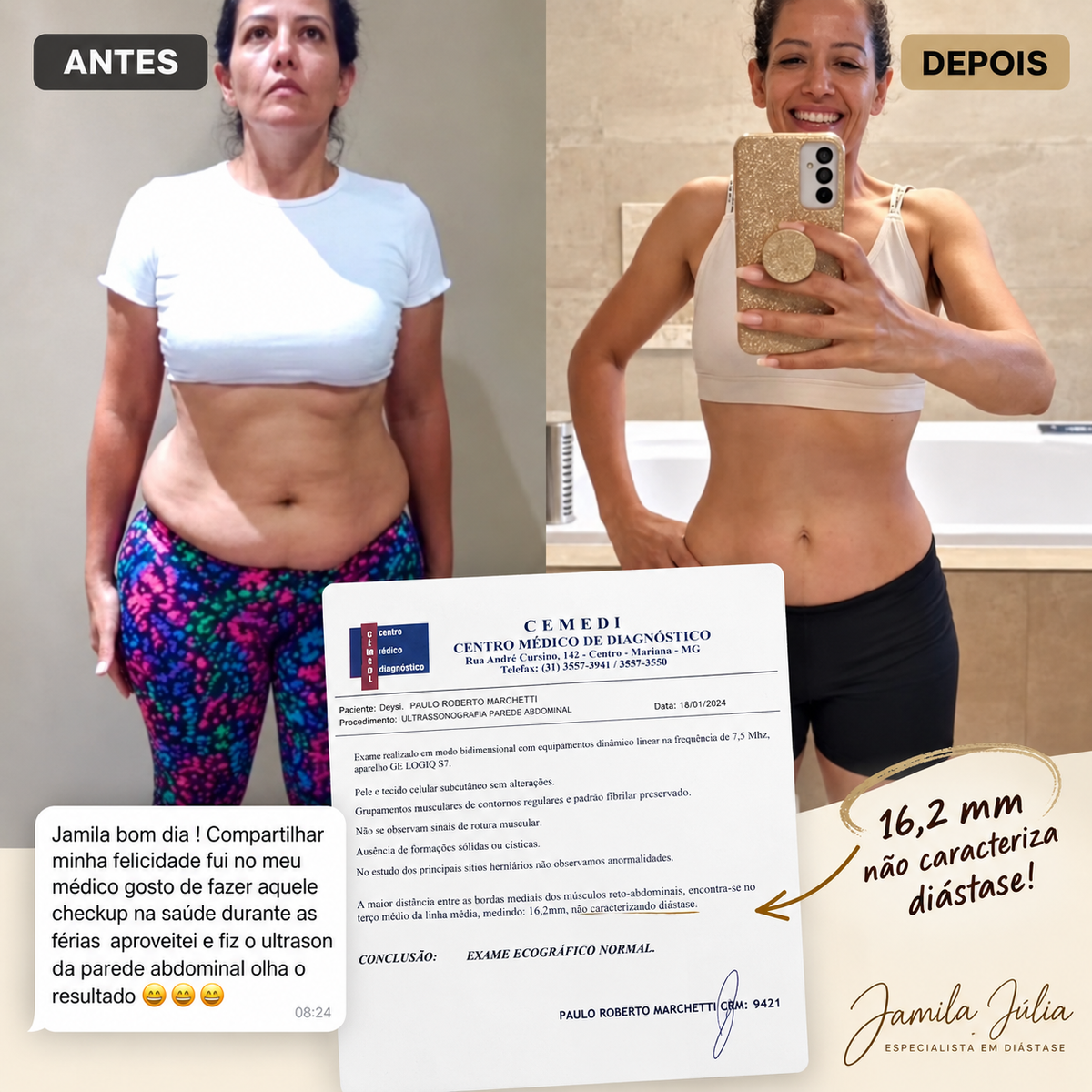 Antes e depois