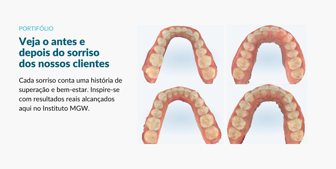 Descreva a imagem...