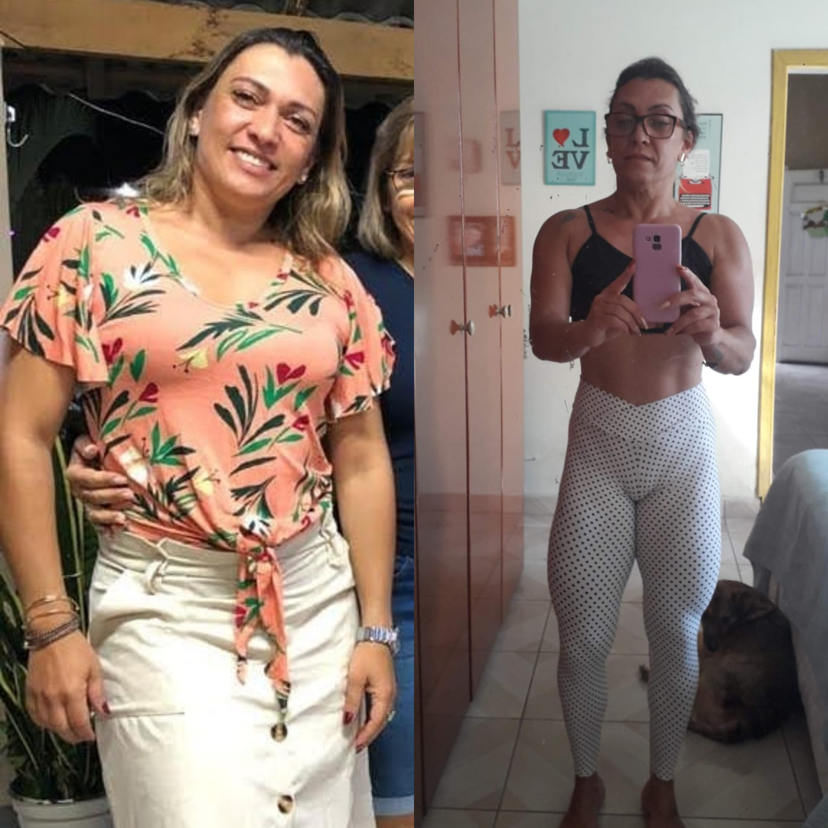 Transformação pós bariátrica